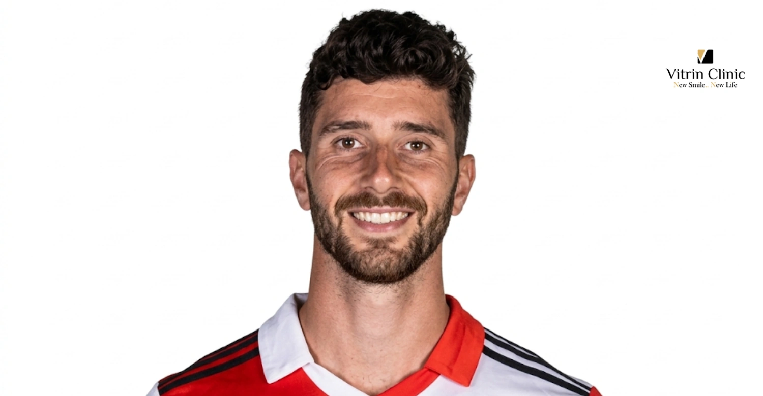 Ne Özellikleri Var Marcos Senesi Gülüşü'nün?